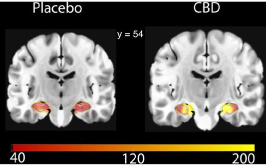 Is there a link between cannabis usage and Dementia?
